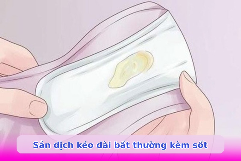 Hậu sản là gì