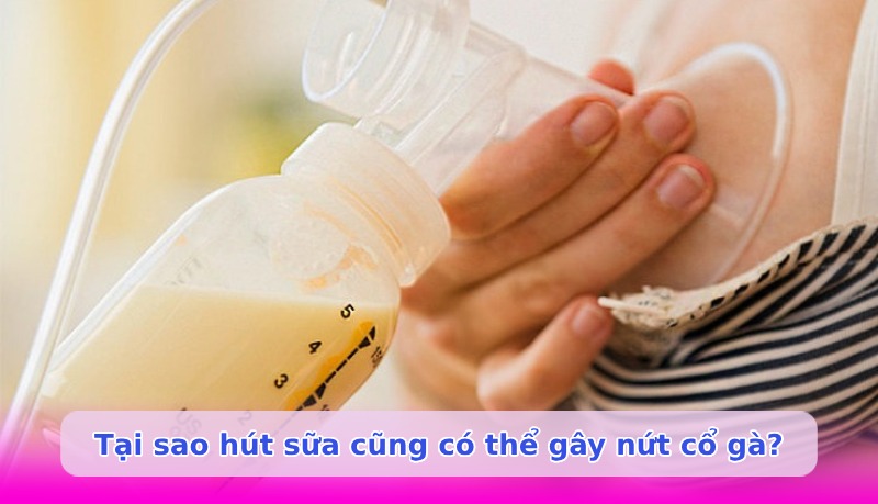 Nứt cổ gà khi hút sữa