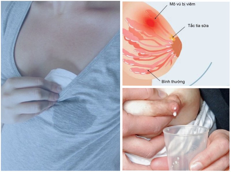 Phản xạ xuống sữa