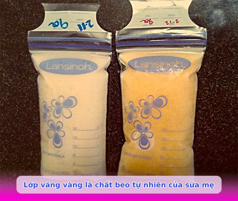 Sữa mẹ có lớp váng màu vàng