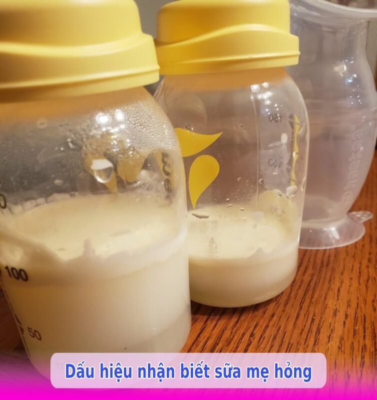 Sữa mẹ có lớp váng màu vàng