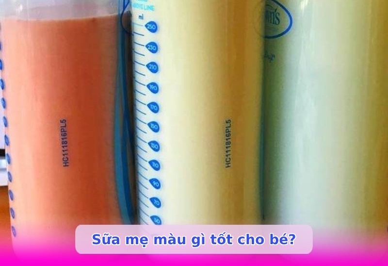 Sữa mẹ màu gì tốt
