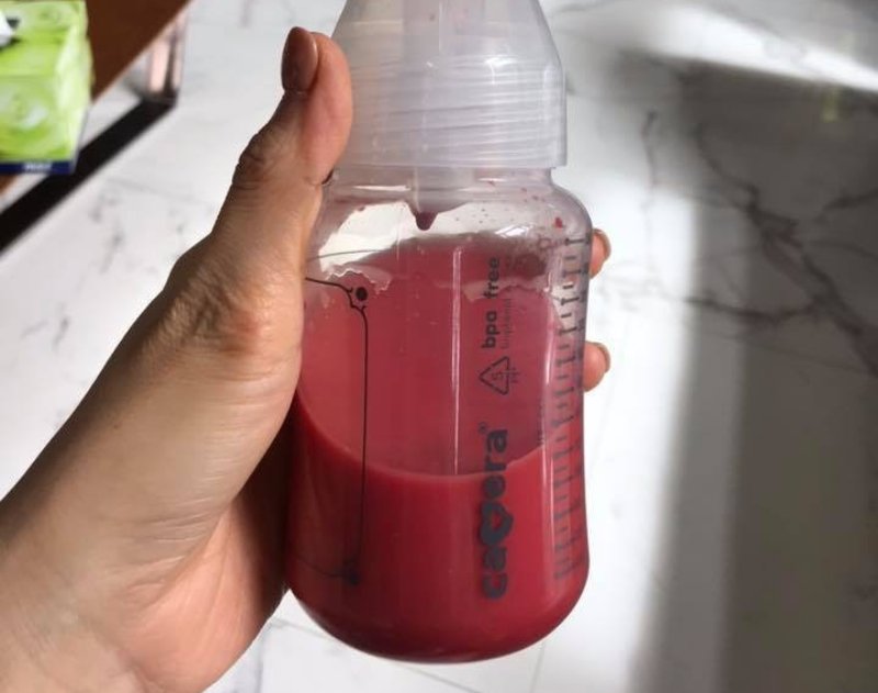 Sữa mẹ màu gì tốt