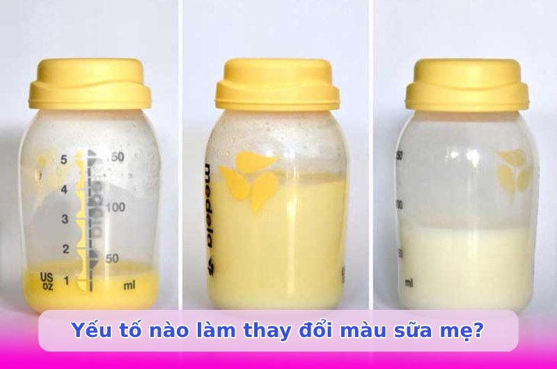Sữa mẹ màu gì tốt