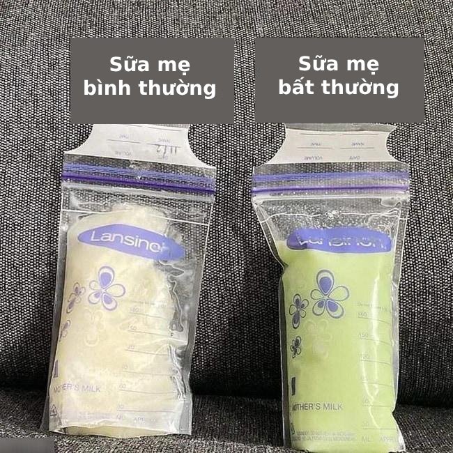 Sữa mẹ màu gì tốt